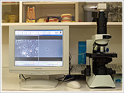 ペリオセーバー（OLYMPUS）位相差顕微鏡